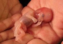 ওষুধ খেয়ে গর্ভপাত করানো কি? গর্ভপাত